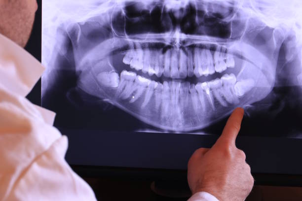 Best Cracked Tooth Emergency Dentist  in K I Sawyer, MI