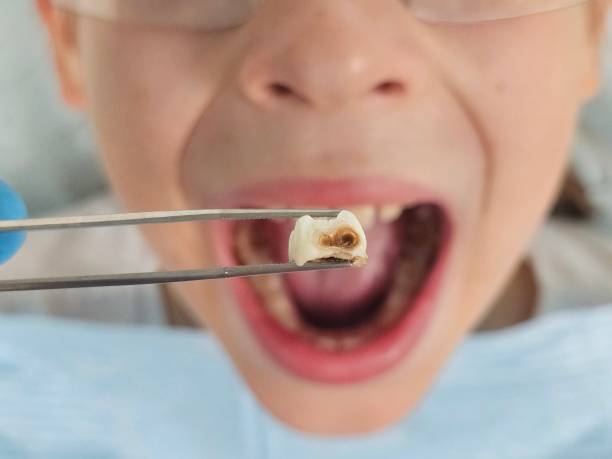 Best Same-Day Dentist Appointment  in K I Sawyer, MI